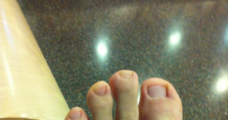 ¿Se puede conducir con un dedo del pie roto?